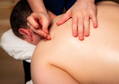 person undergoing acupuncture treatment